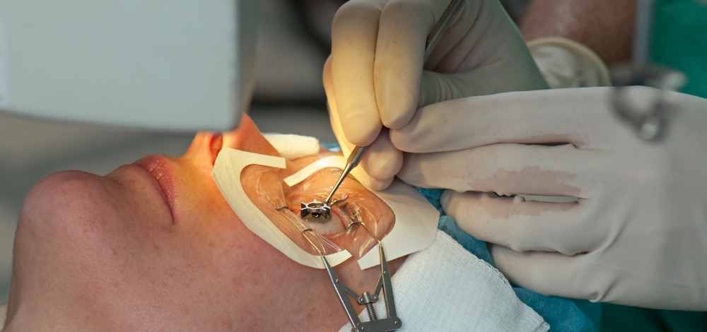 A Patient Undergoing LASIK Surgery in the Philippines

