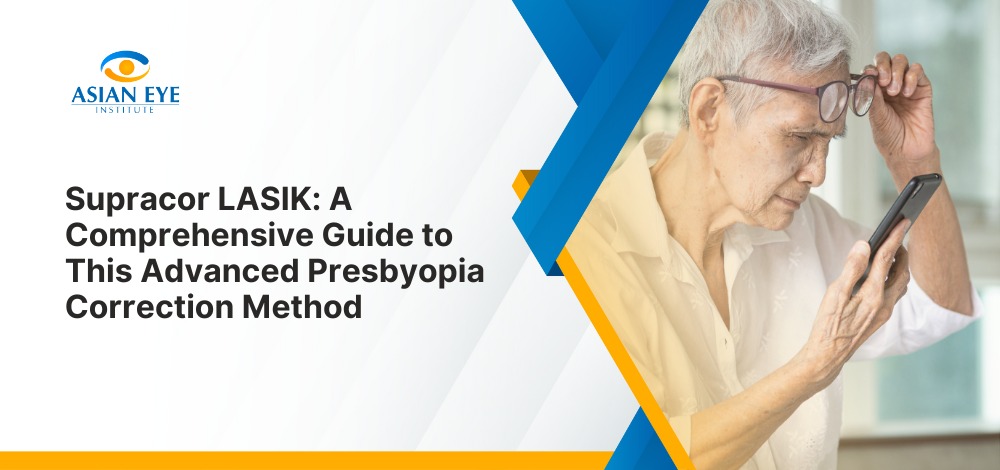 Supracor LASIK: A Comprehensive Guide to This Advanced Presbyopia Correction Method