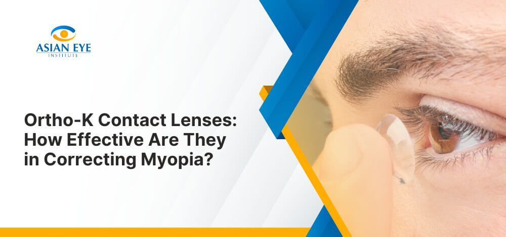 Ortho-K Contact Lenses: How Effective Are They in Correcting Myopia?