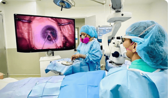 cataract surgery