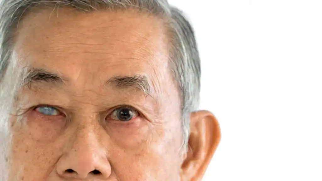 a patient with Glaucoma