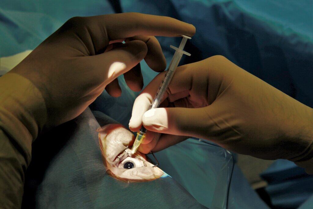 ophthalmologist doing retinal injection