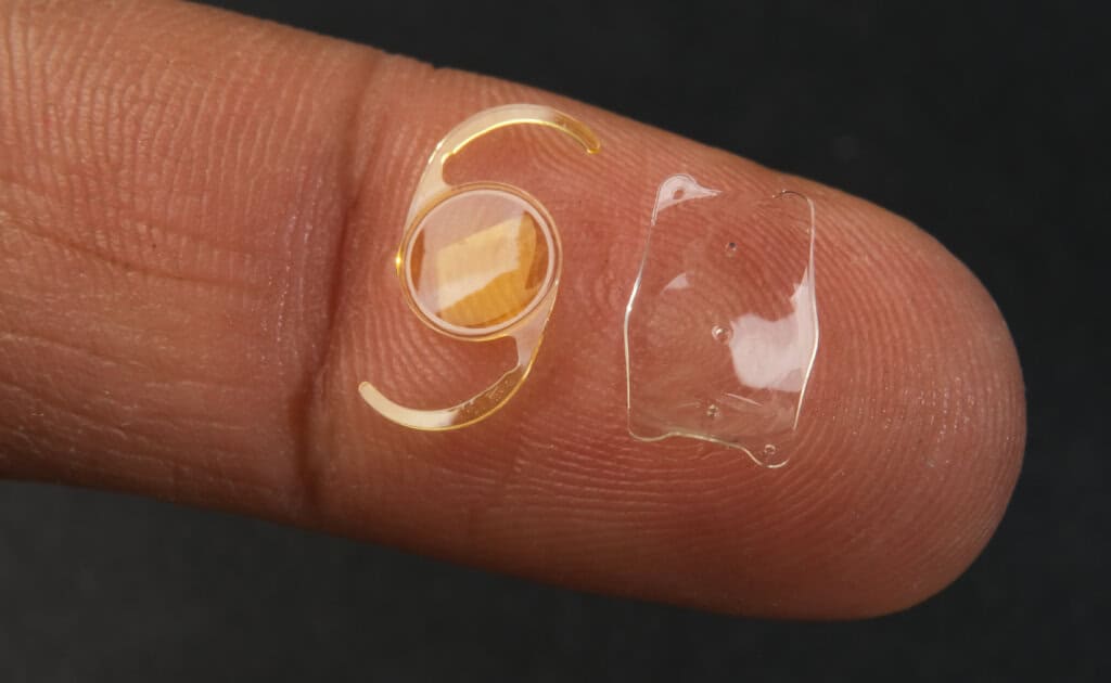 implantable collamer lens