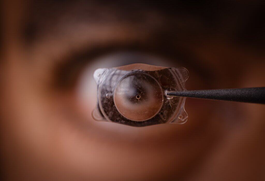 Myopia vs Hyperopia vs Presbyopia vs Astigmatism | Asian Eye Institute