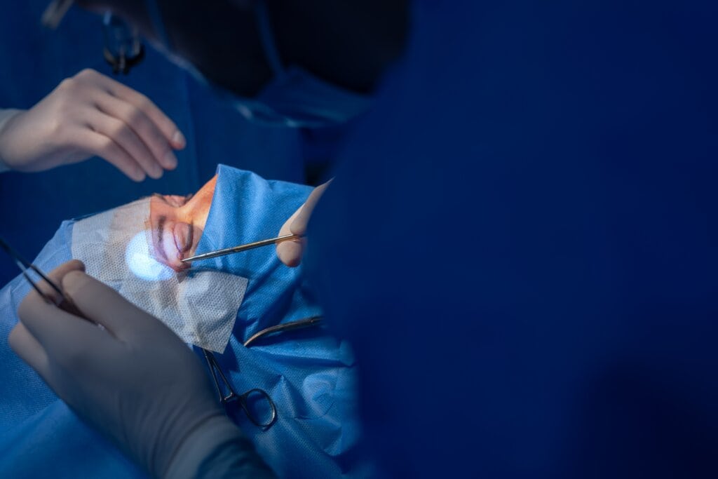 Blepharoplasty Surgery
