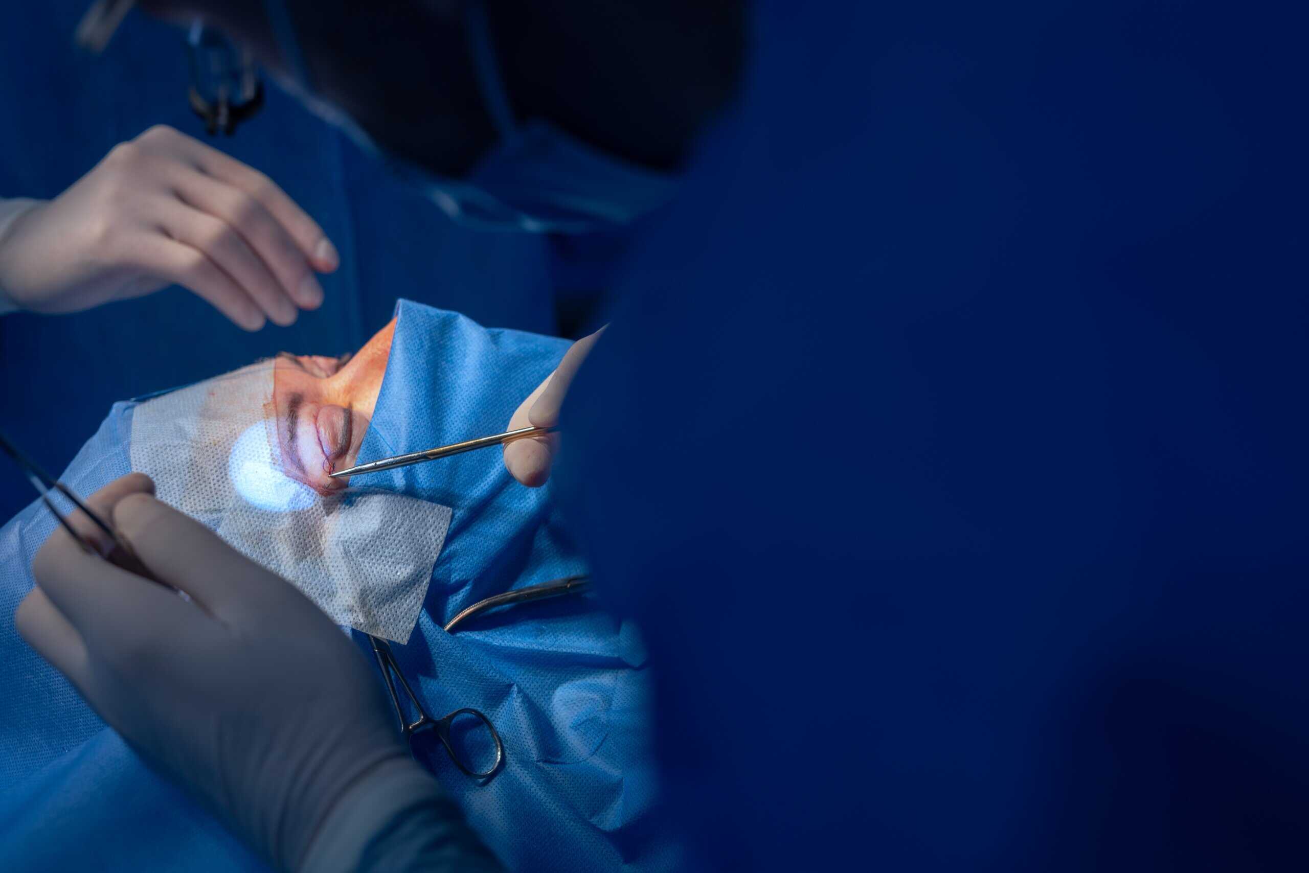 Blepharoplasty Surgery