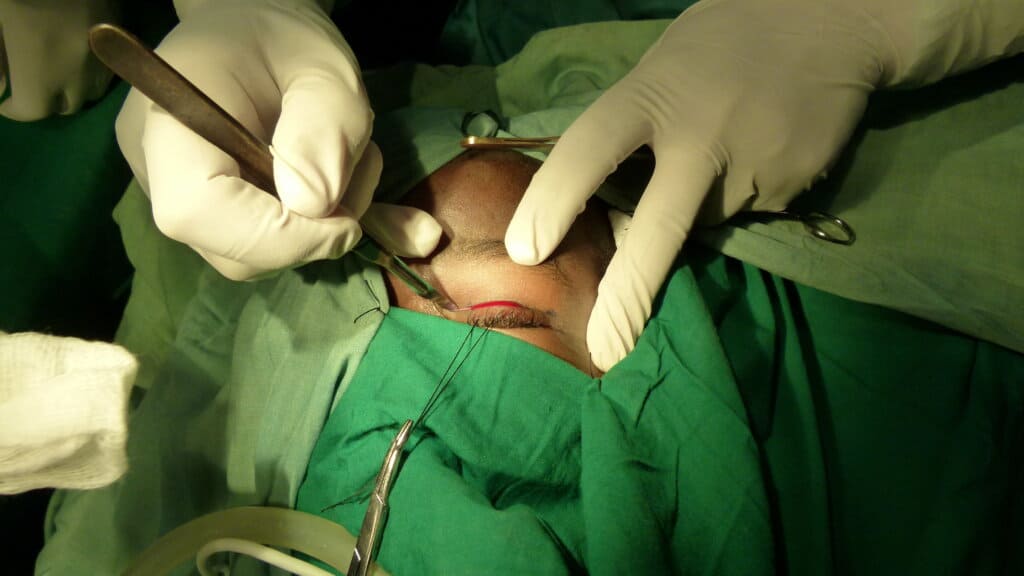 Ptosis surgery
